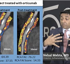 Interview with Nehal Mehta, MD, University of Pennsylvania, who explains how coronary inflammation can be seen using AI on cardiac CT scans to better risk stratify patients and begin preventive drug therapy.