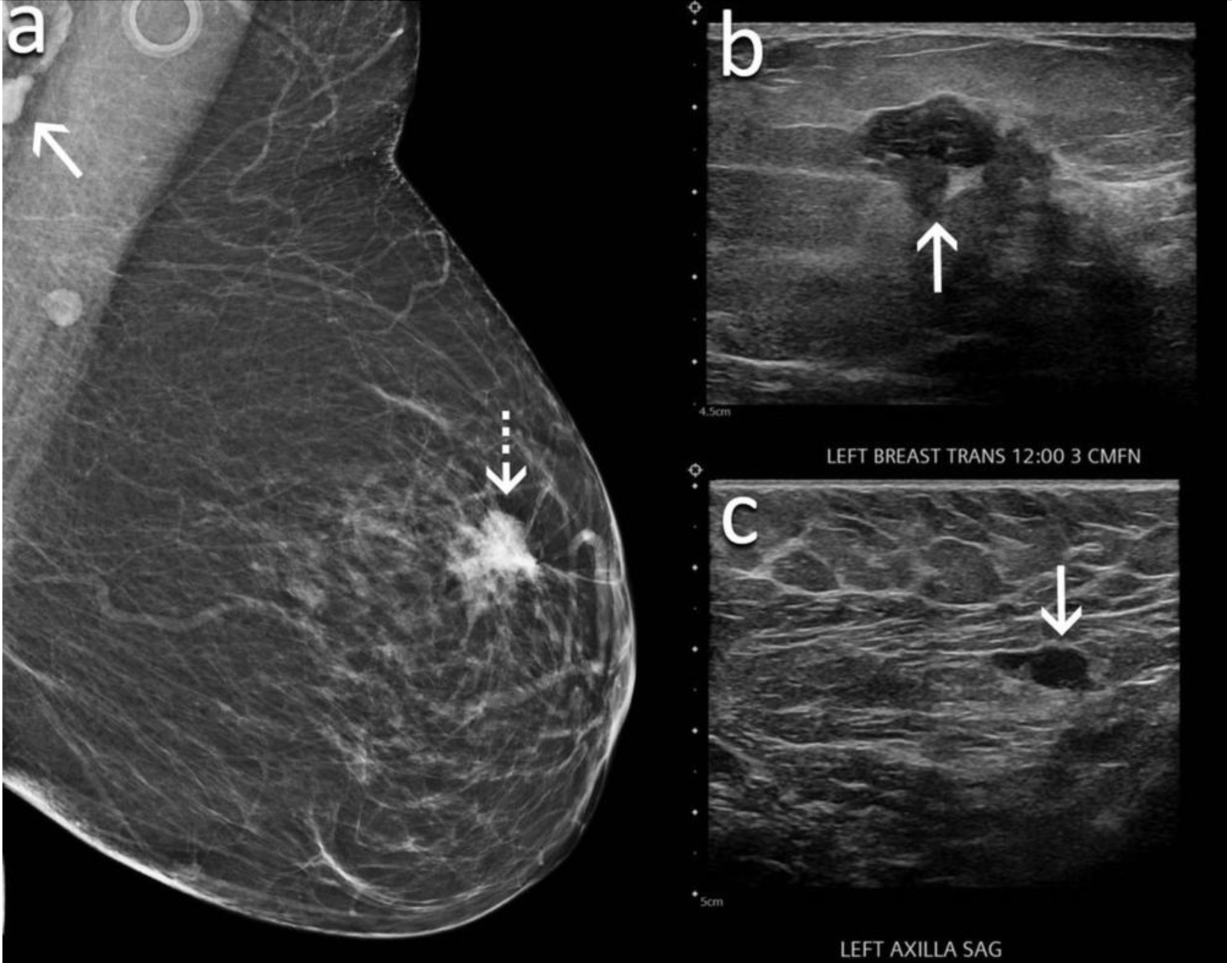 Breast Ultrasound  MIC Medical Imaging