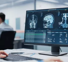 Monique Rasband, vice president of imaging, cardiology and oncology, KLAS Research, explains some of technology trends KLAS researchers have found in enterprise imaging system and radiology artificial intelligence (AI).