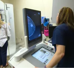 A mammography exam in progress with the patient on the breast imaging system and the technologist acquiring images. The image on the screen shows a suspect lesion.