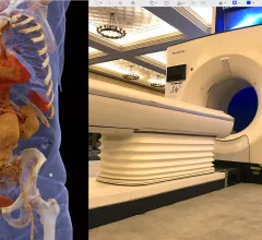 Advances in computed tomography scanner (CT) technology include photon-counting (Siemens image left) and faster, higher slice CT systems with integrated AI. Right image is GE Healthcare's Revolution on display at SCCT 2022. Trends in CT imaging by Signify Research.