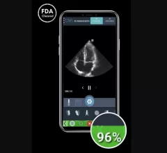 DiA Imaging Analysis, an Israel-based healthcare technology company, has gained U.S. Food and Drug Administration (FDA) clearance for LVivo IQS, a new software solution designed to help users acquire high-quality echocardiography images.