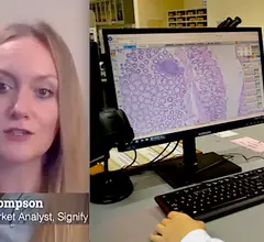 Signify Research analyst Amy Thompson discusses connecting pathology and others with enterprise imaging systems.