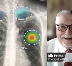 Radiology IT expert Rik Primo discusses trends he sees in imaging informatics at HIMSS and RSNA. 