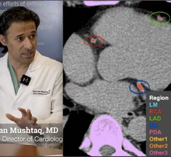 Nauman Mushtaq, MD, Northwestern Medicine, explains the value of CT coronary calcium scoring for patients and for the cardiology business model.