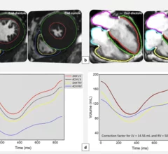 Researchers have developed and validated a new artificial intelligence (AI) model capable of producing four-chamber cardiac MR (CMR) images in seconds, publishing their findings in European Radiology Experimental.