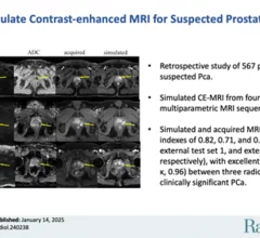 Simulated MR images could eliminate the need for contrast in prostate scans.