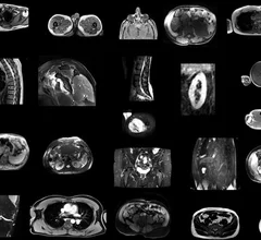 New AI model segments 80 MRI structures