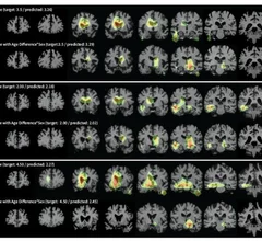 AI detects subtle changes in images over time.