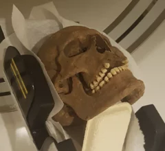 Researchers use CT scans to study Viking skulls.