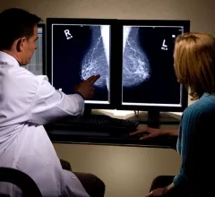 Danish researchers reported in Radiology that an artificial intelligence system was able to interpret more than 114,000 screening mammograms using a reading protocol with high sensitivity and specificity.