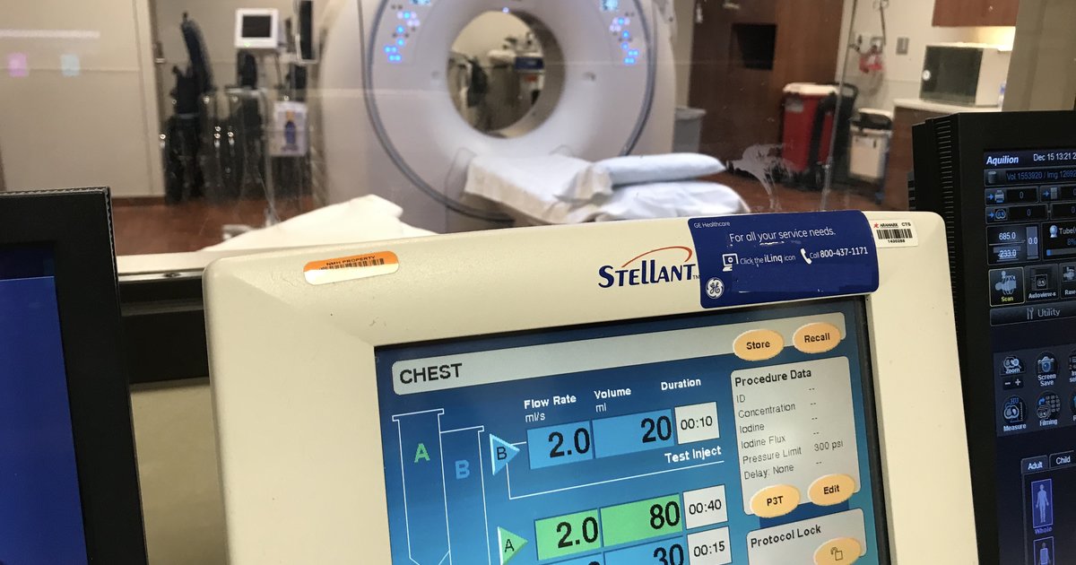 希釈造影剤のテストボーラスはCTA中のスキャンタイミングを最適化します