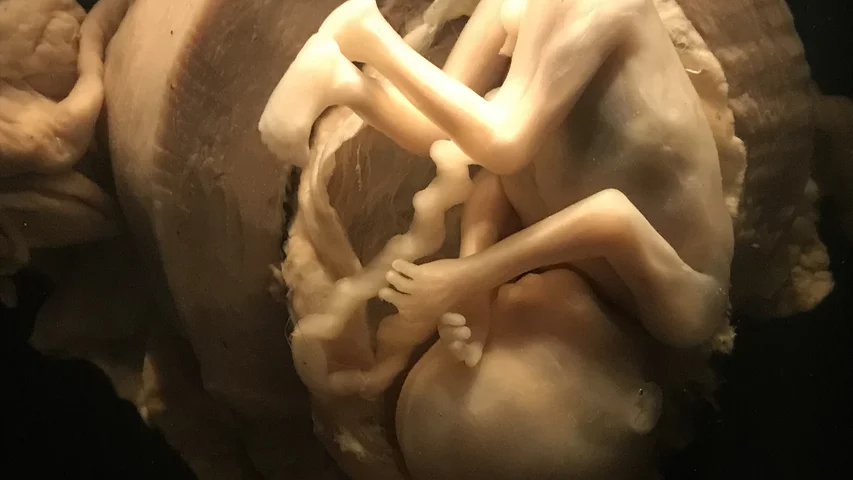 A preserved 14-week-old fetus inside the uterus on display as part of a permanent exhibit on the stages of fetal development at the Chicago Museum of Science and Industry. Link to museum's virtual tour. This image helps show correlation with fetal medical imaging. Photo by Dave Fornell 