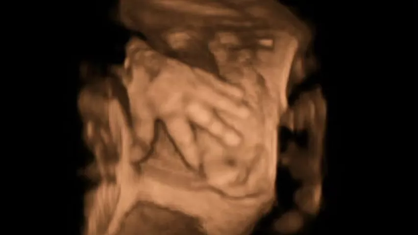 Fetal hand in a 3D ultrasound. Image courtesy of Hitachi. Baby hand photo on ultrasound. Fetal imaging. Example of a baby ultrasound. Foetus ultrasound.