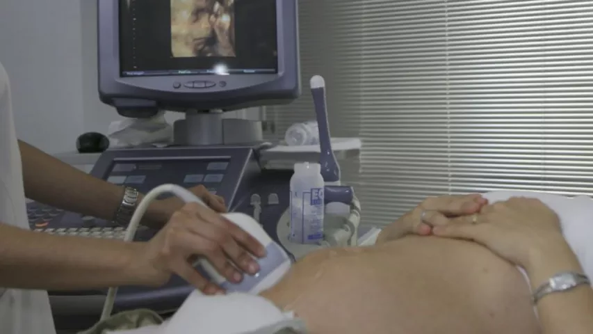 A patient undergoing a fetal ultrasound exam. Fetal imaging. Example of a baby ultrasound.
