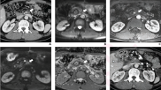 Photo and caption courtesy of American Journal of Roentgenology (AJR), American Roentgen Ray Society (ARRS). Used with permission.