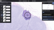 Paige Breast Lymph Node Screenshot