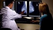 Danish researchers reported in Radiology that an artificial intelligence system was able to interpret more than 114,000 screening mammograms using a reading protocol with high sensitivity and specificity.