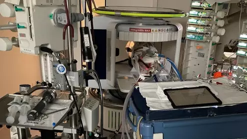 portable MRI in pediatric ECMO setting
