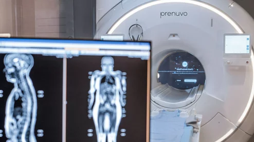 Prenuvo MRI Sollis Health