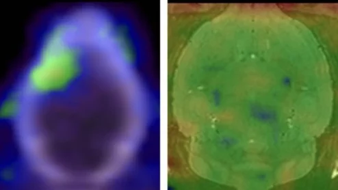 ALS drug repurposed for PET imaging