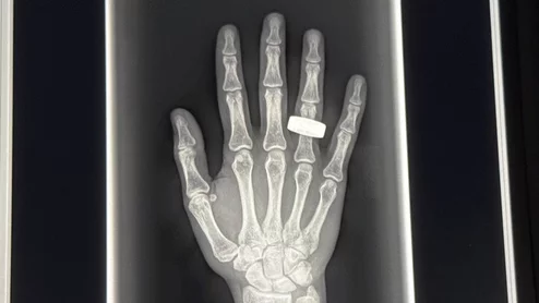 Chun Wang shares first medical radiographs captured in space.
