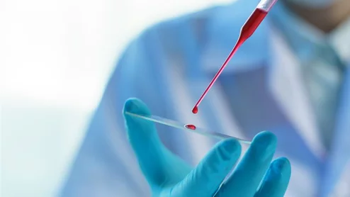 blood test research laboratory