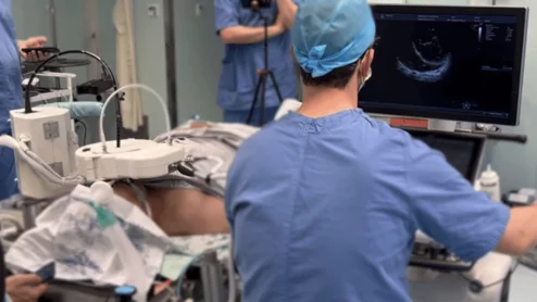 ROB’E Robotic transesophageal echocardiography (TEE). ROB’E, a German startup, has developed a new remote-controlled robotic (RCR) system with these challenges in mind. Users are able to remotely manipulate TEE probes, performing precise movements and even saving specific positions so they can be duplicated as needed.