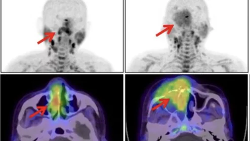 2025 SNMMI Image of the Year