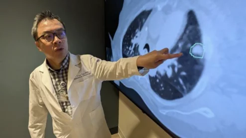 Troy Teo explains iSeg AI tool for lung tumor segmentation.
