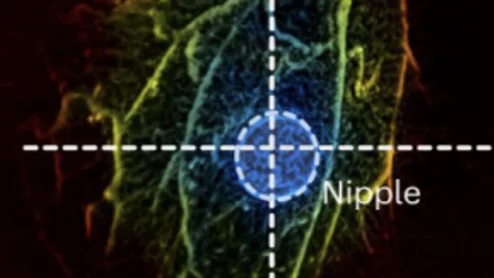 PACT could offer painless alternative to mammograms