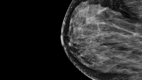 WashU AI device earns FDA's Breakthrough Device designation.