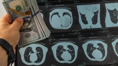imaging radiology money scans compensation pay dollar