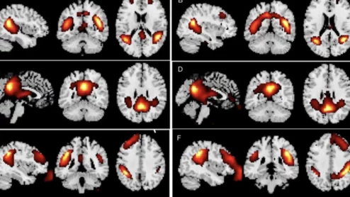 Prompt engineering experts' brains are wired differently