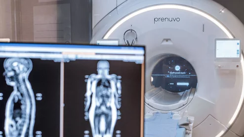 Prenuvo whole-body MRI