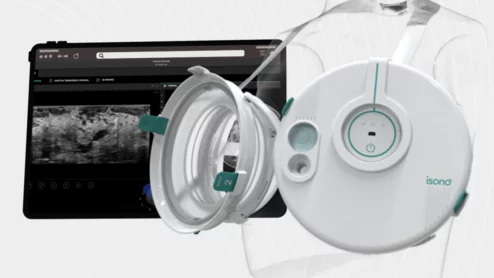iSono Health announces commercial launch of portable, wearable breast ultrasound device
