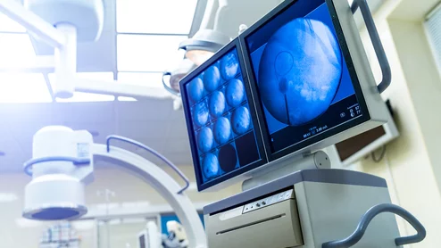 fluoroscopy