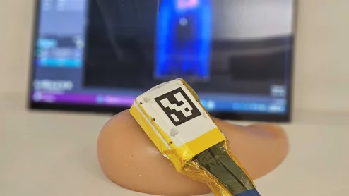 MIT cancer ultrasound
