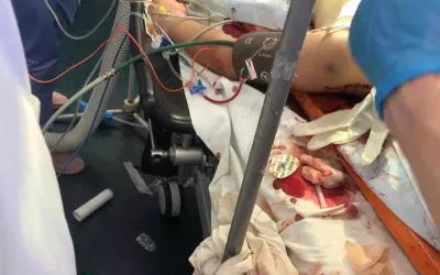 Boy from Kyiv area who was shot during the Russian advance on the city. Wounded on his side and neck and had a concussion. In the intensive care at Ohmatdyt pediatric hospital (https://ohmatdyt.com.ua/en/) intensive care unity in Kyiv Feb. 27, 2022. The military called an ambulance, and doctors performed an emergency surgery.