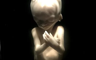 A preserved 18-week-old fetus on display as part of a permanent exhibit on the stages of fetal development at the Chicago Museum of Science and Industry. Link to virtual tour of the exhibit. This image helps show correlation with fetal medical imaging. Photo by Dave Fornell 