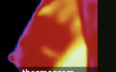 Breast Thermogram is not an alternative to mammography. Image from the U.S. FDA