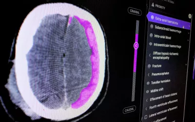 Example of an AI finding highlighted by a brain algorithm shown by Annalise.AI at RSNA 2022. The colored areas can show where the AI believes there is an abnormality. The FDA does not like the color coding on AI apps and prefers the AI to just indicate there is an issue on and exam to alert the radiologist to then find the detected problem. Many of the color coded exams seen at RSNA are cleared for use outside the U.S.