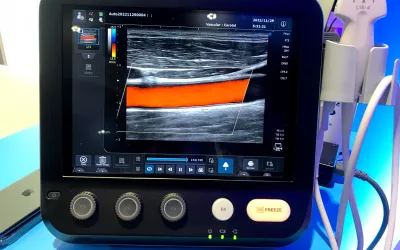 A carotid artery assessment on a point-of-care-ultrasound system (POCUS) in the Konica-Minolta booth at RSNA.