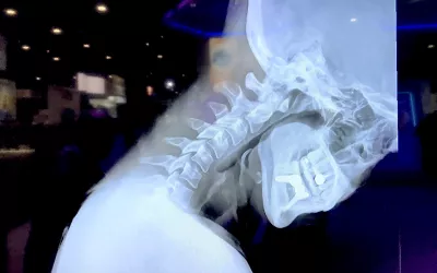 Konica-Minolta's DDR moving X-ray technology. This allows a fluoro video dynamic pulsed X-rays to be viewed for swallow and orthopedic assessments. The vendor said this technology is now available on its mobile DR systems.