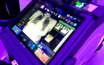 The mKDR Express mobile DR X-ray from Konica Minolta. #RSNA #RSNA