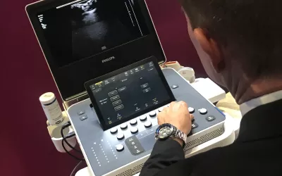 Live ultrasound imaging using a new portable system released by Philips at RSNA 2022.