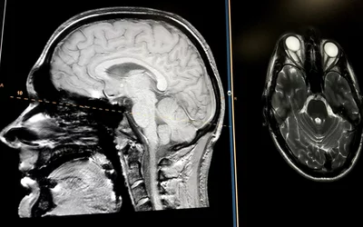 Brain MRI views on an Intelerad PACS at RSNA 2022. 