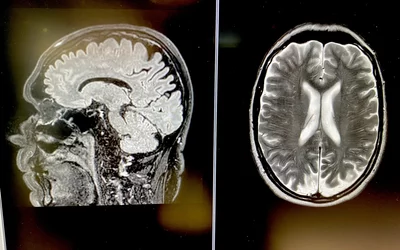 Brain MRI images of a Philips Blue Seal 1.5T system. #RSNA #RSNA23 #RSNA2024