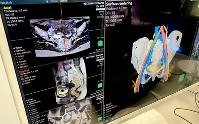  AI anatomical countering and labeling on an MRI rectum exam performed on a Fujifilm radiology workstation. Most PACS vendors now offer AI workflow enhancement tools to save post-processing time for radiologists. The AI was cleared in February 2021.