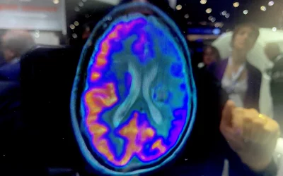 Example of brain perfusion PET-CT from a Siemens Biograph Vision X system at RSNA 2023.Photo by Dave Fornell. #RSNA #RSNA23 #RSNA2023